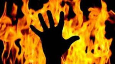 College girl suffers burns as stalker sets her on fire in Manikganj